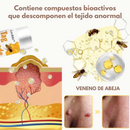 Tag Recede™| Eliminador de verrugas