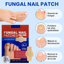Parches ANTI-HONGO - combate hongos, aclara y refuerza tus uñas