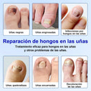 Parches ANTI-HONGO - combate hongos, aclara y refuerza tus uñas
